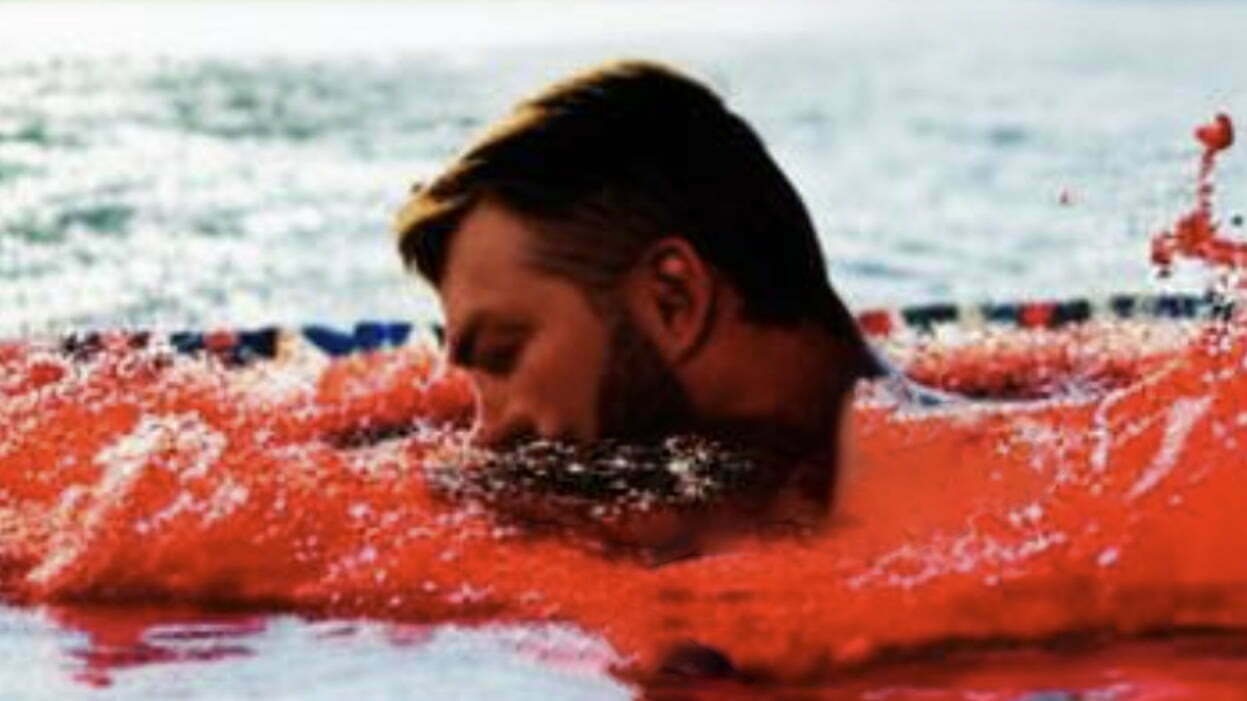 Tim Harrison Creates a Red Cloud in the Family Swimming Pool After Eating Pickled Beetroot